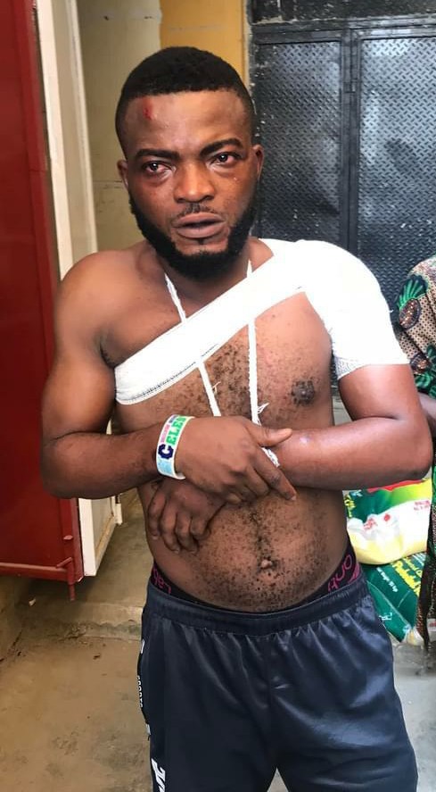 Lagos Police officers torture artisan for allegedly being a Yahoo boy