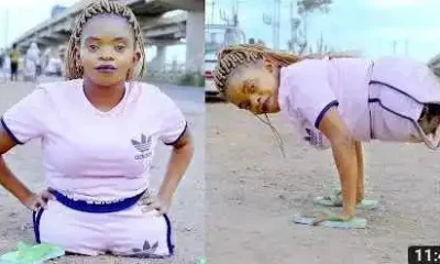 Lady Born Without Legs