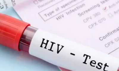 160,000 kids living with HIV in Nigeria