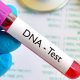 DNA: Medical errors, inaccuracies in genetic testing, and baby exchange, among others responsoble For Paternity Errors
