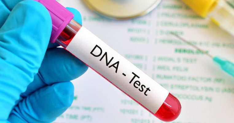 DNA: Medical errors, inaccuracies in genetic testing, and baby exchange, among others responsoble For Paternity Errors