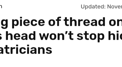 Does Placing Strand Of Wool On Head Stop Hiccups?