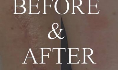 🌿 The Beauty in My Scar: Finding God’s Message in Your Mess By FEMI OYEWALE